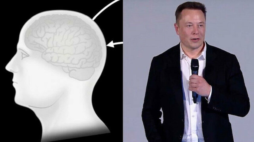 Elon Musk yeni çılgın projesi Neuralink'i tanıttı